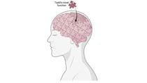Tip60’s novel function is a critical piece in the brain puzzle that brings us one step closer to understanding the big picture behind Alzheimer’s Disease. Image was generated using BioRender.
